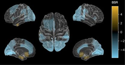 aphantasia and psychedelics drugs