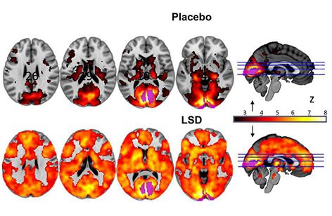 lsd og lsdsvampe to forskellige ting